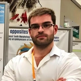 «Удержать 30-метрового зауропода когтями — не лучший вариант»: почему у тираннозавра были такие крошечные «лапки»?