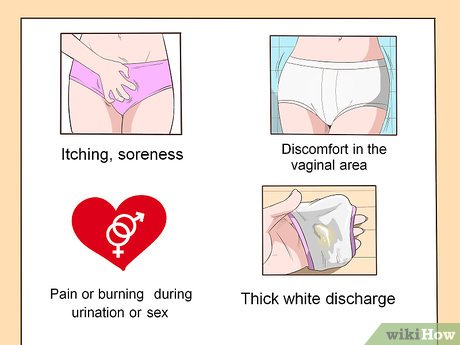 Как вылечить молочницу — wikiHow